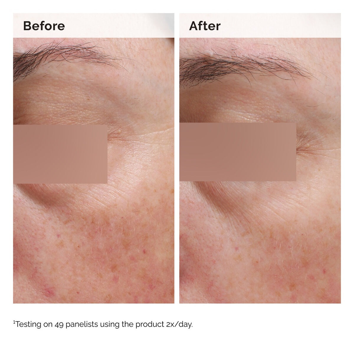 The Ordinary Niacinamide 5% Face and Body Emulsion 100ml