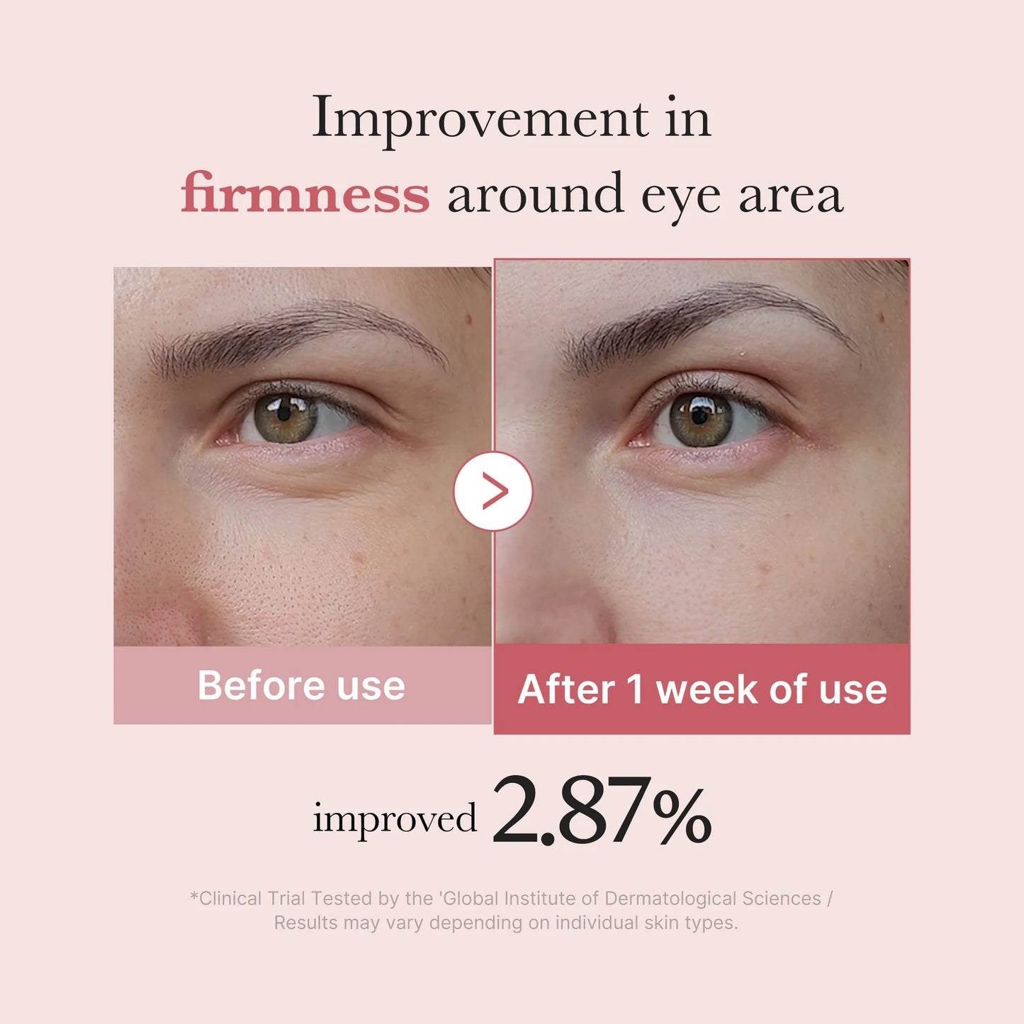 Medicube PDRN Pink Peptide Eye Cream 30ml