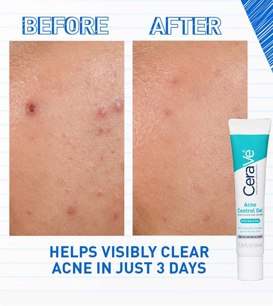 CeraVe Acne Control Gel 40ml