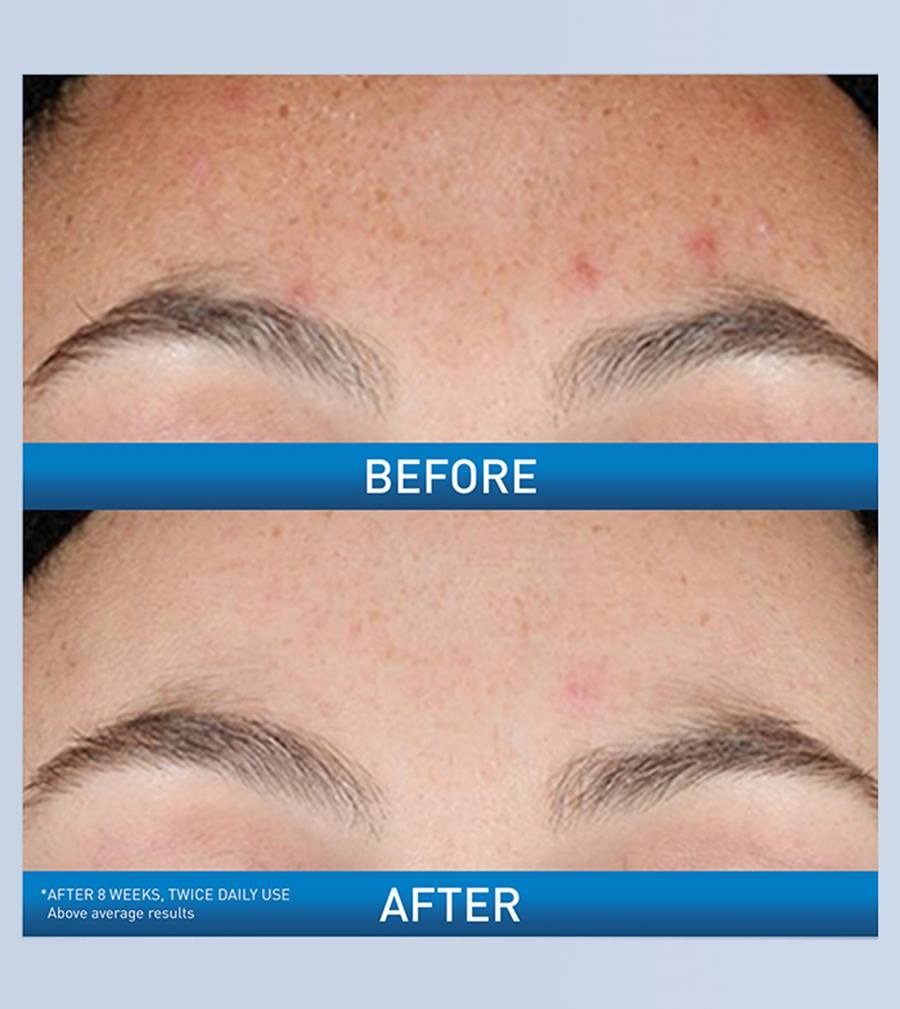 CeraVe Resurfacing Retinol Serum 30ml